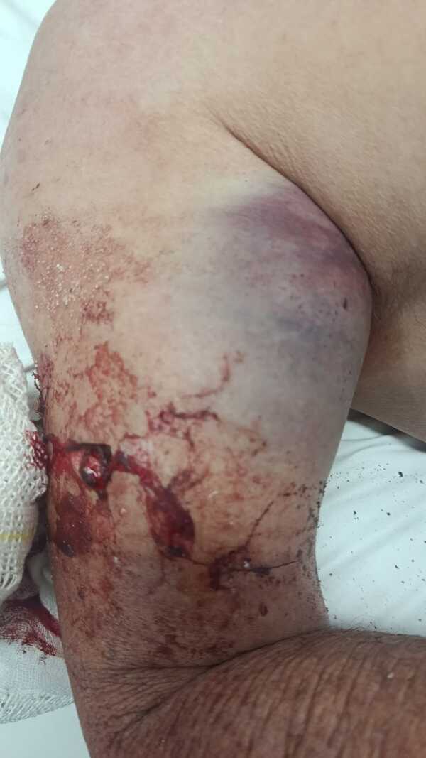 Popular / ¡Terrible! Hijo acuchilló a su propio padre tras discusión