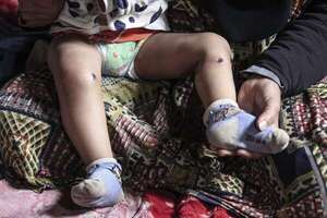 ¿Tortura? Un bebé gazatí sufre quemadura de cigarrillo tras ser retenido por Israel - Mundo - ABC Color