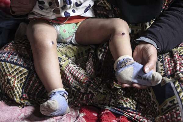 ¿Tortura? Un bebé gazatí sufre quemadura de cigarrillo tras ser retenido por Israel - Mundo - ABC Color