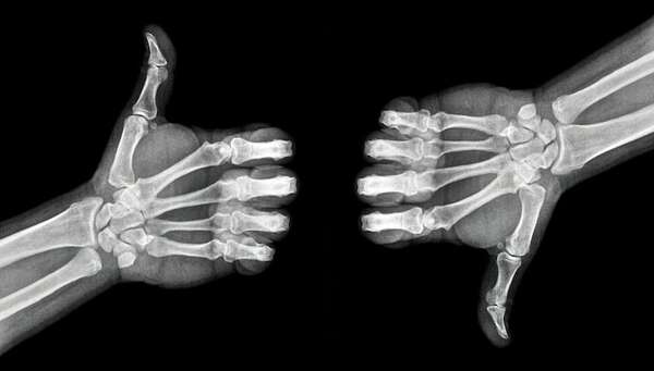 La IA logró engañar a radiólogos con radiografías falsas, según un estudio - Tecnología - ABC Color