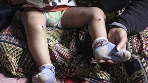Un bebé gazatí sufre heridas y una quemadura de cigarrillo tras ser retenido por Israel