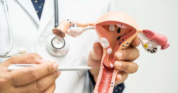 Diario HOY | Unas 120 mujeres perdieron la vida por cáncer de cuello uterino el año pasado