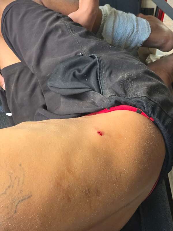 Luque: riña entre adictos deja a uno gravemente herido - Policiales - ABC Color