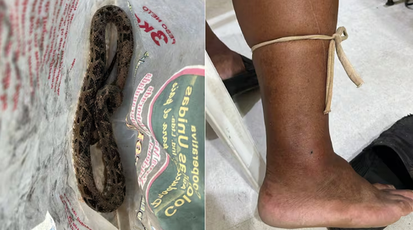 Pesca casi acaba en tragedia: hombre fue mordido por una yarará en Pilar