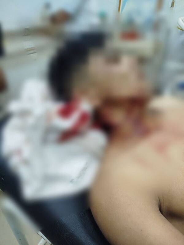 Joven sufrió grave herida en el cuello con foisa en Horqueta - Concepción al Día