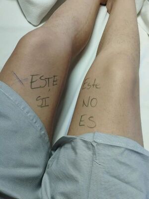 Por si acaso, doctor: paciente se señala la pierna correcta antes de la cirugía