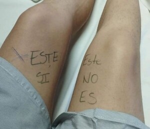 Joven se marca la pierna antes de cirugía para evitar error médico