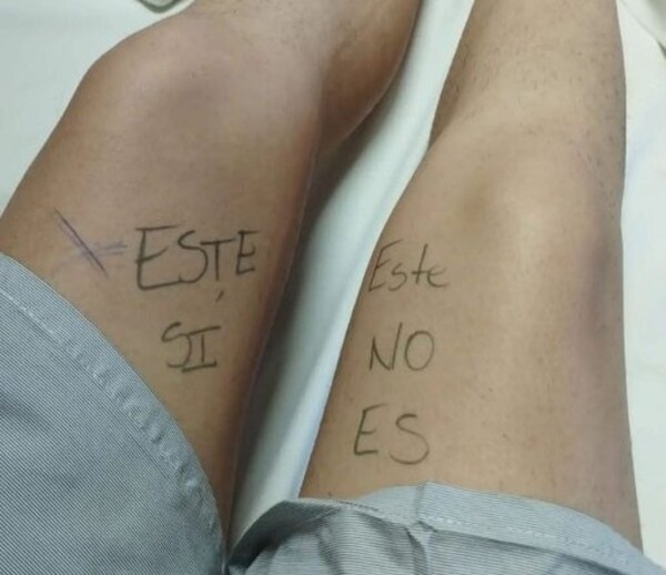 Joven se marca la pierna antes de cirugía para evitar error médico