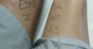 Diario HOY | Paciente se escribió en la pierna para que cirujanos no se equivoquen