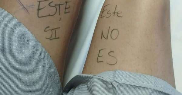Diario HOY | Paciente se escribió en la pierna para que cirujanos no se equivoquen