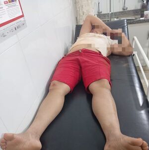 Mujer motociclista resulta herida tras caída en San Alfredo - Concepción al Día