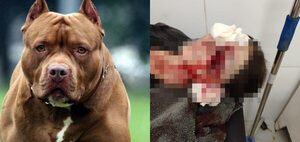 Pitbull atacó a su propia dueña y la dejó con el rostro desfigurado - trece