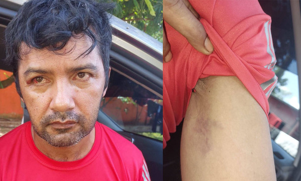 Denuncian supuesta agresión de concejal y funcionario estatal contra beneficiario de Tekoporã en San Joaquín - OviedoPress