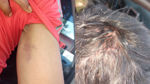 Denuncian a concejal municipal y un funcionario por agredir a una persona con discapacidad