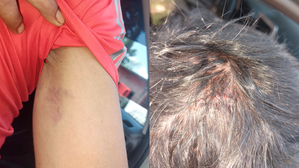 Denuncian a concejal municipal y un funcionario por agredir a una persona con discapacidad