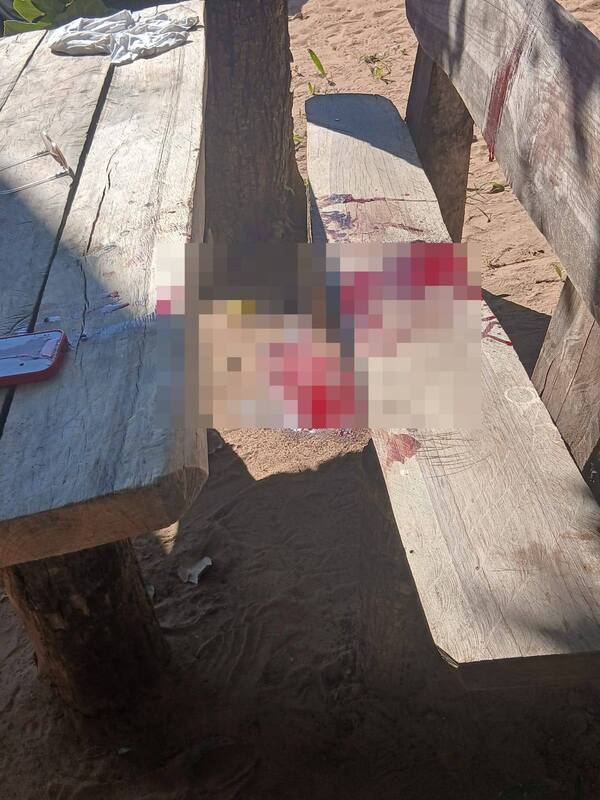 Popular / Milico quedó mal herido tras dispararse "sin querer"