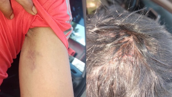 Denuncian a concejal por agresión a persona con discapacidad