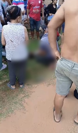 Niño de 5 años sufre fractura de fémur y traumatismo de cráneo tras accidente en Concepción - Concepción al Día