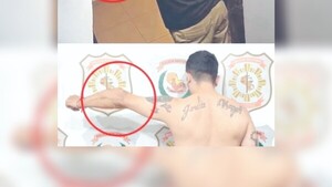 Le pillaron por molde de su brazo y fue apresado