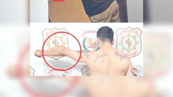 Le pillaron por molde de su brazo y fue apresado