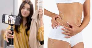 La Nación / ¿La “mini lipo” promocionada por influencers es riesgosa? Cirujano responde