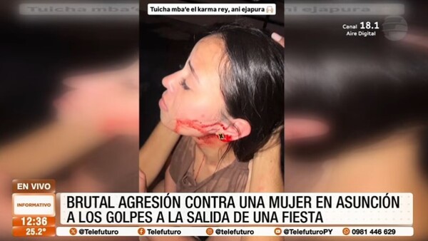 Brutal agresión a una joven a la salida de una discoteca en Carmelitas