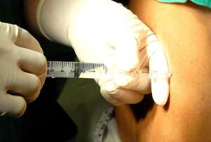 AUDIO: Sobredosis de médicos no son casos aislados, según viceministro de Salud - ABC AM 730 - ABC Color