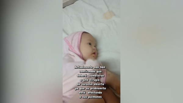 Solidaridad por Gianna Valentina: bebé necesita apoyo para enfrentar cirugía cardíaca