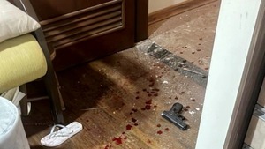 Corte cierra caso por muerte de “Lalo” Gomes y ratifica actuación policial - ADN Digital