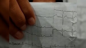 Médico denuncia que se hace inspección médica escolar mau: “Esto es lo más bajo que he visto”