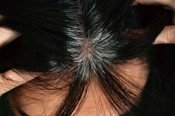 ¿Se pueden revertir las canas con tratamientos?  - Estilo de vida - ABC Color