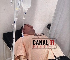 Agreden a jefe de prensa de la Gobernación de San Pedro durante actividad con la primera dama