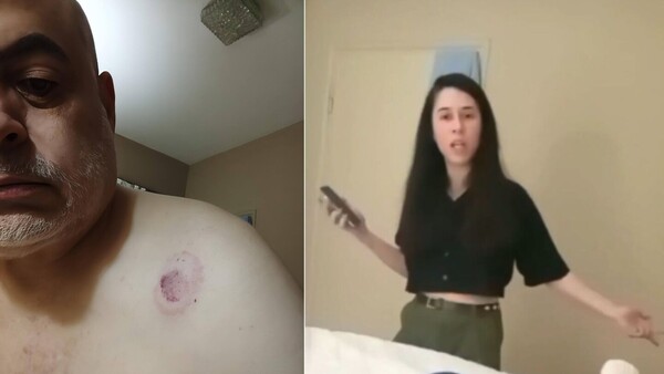 Payo Cubas dijo que su exnovia le atacó con los dientes