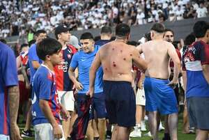 La impactantes imágenes del Superclásico que terminó en emergencia humanitaria - Superclásico - ABC Color