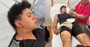 Diario HOY | Denuncian golpiza a jóvenes detenidos por millonario “cibergolpe” en Encarnación