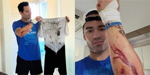 Popular / (GALERÍA) Renato Prono y un feo accidente: "Feliz de poder estar contando la historia"