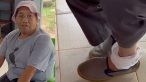 Un aguará mordió a una doña de 70 años