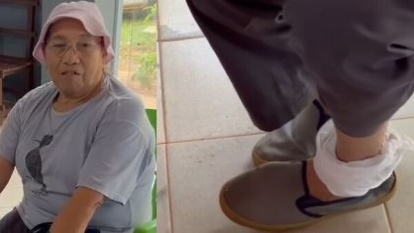 Un aguará mordió a una doña de 70 años