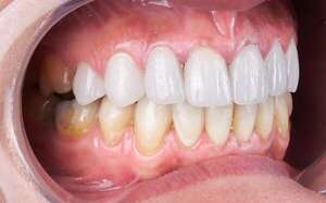 Más allá del blanco: lo que dice el tono natural de tus dientes sobre tu salud - Estilo de vida - ABC Color