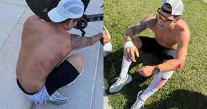Diario HOY | Renato Prono sufrió accidente en Brasil y no pudo completar triatlón