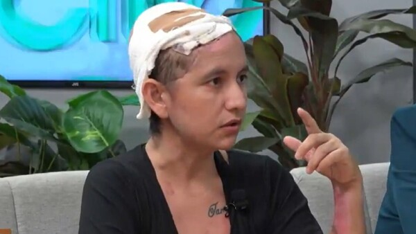 “Es un milagro poder estar de vuelta con mi gente”, dice mujer que perdió el cuero cabelludo tras accidente