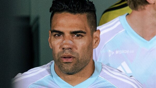 Millonarios confirma que Falcao García no requiere cirugía para tratar lesión en el rostro