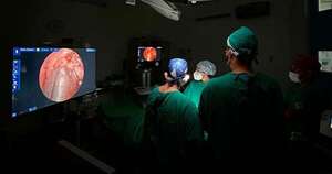 Diario HOY | INERAM concreta cirugía clave para detectar cáncer de pulmón