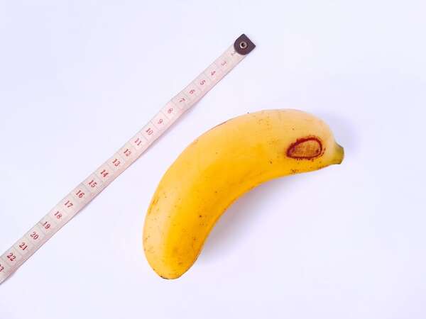 ¿Qué se considera un micropene? Más allá de los chistes y el estigma - Sexualidad - ABC Color