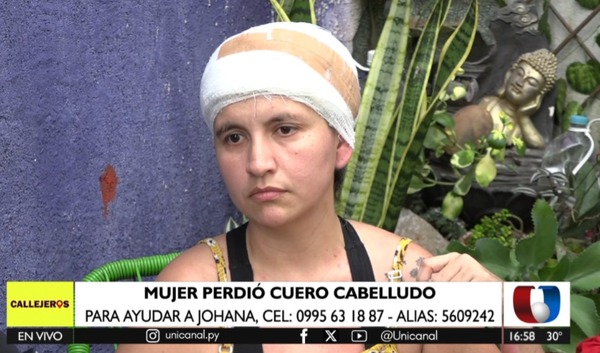 Mujer que perdió cuero cabelludo en accidente pide ayuda | Unicanal