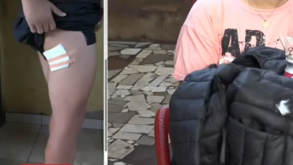 Estudiante fue atacado y sobrevivió gracias a su campera rompevientos