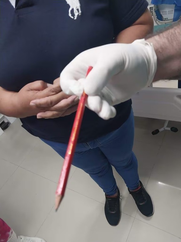 Niño sufre perforación intestinal tras “broma” de compañeros en Limpio | Unicanal