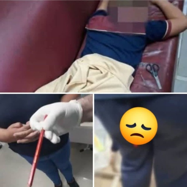 Broma escolar terminó con un niño gravemente lesionado