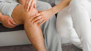 “Me rompí la rodilla y mi novia no viene a verme y farrea full”