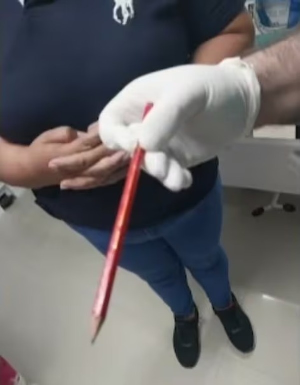 Un niño sufrió perforación en el intestino a causa de bullying - ADN Digital